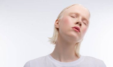 Malawi: Après avoir tué un albinos , 3 hommes ont été condamnés à 155 ans de prison