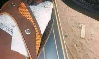 Incroyable : Au Zimbabwe , les gens vendent leurs orteils pour avoir de l'argent