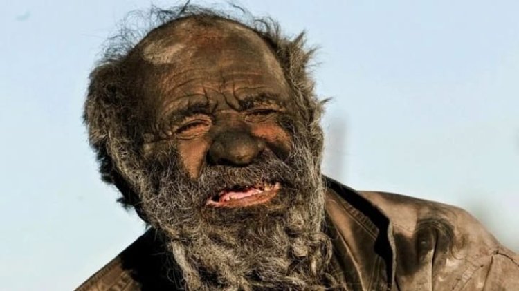 Incroyable: A la découverte de L’homme le plus sale du monde