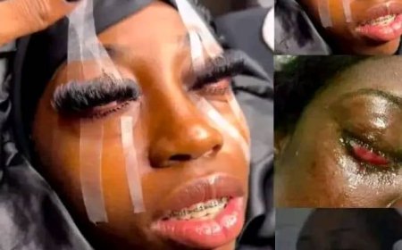 Tshopo: une jeune dame devient aveugle suite au mauvais traitement de beauté de ses cils
