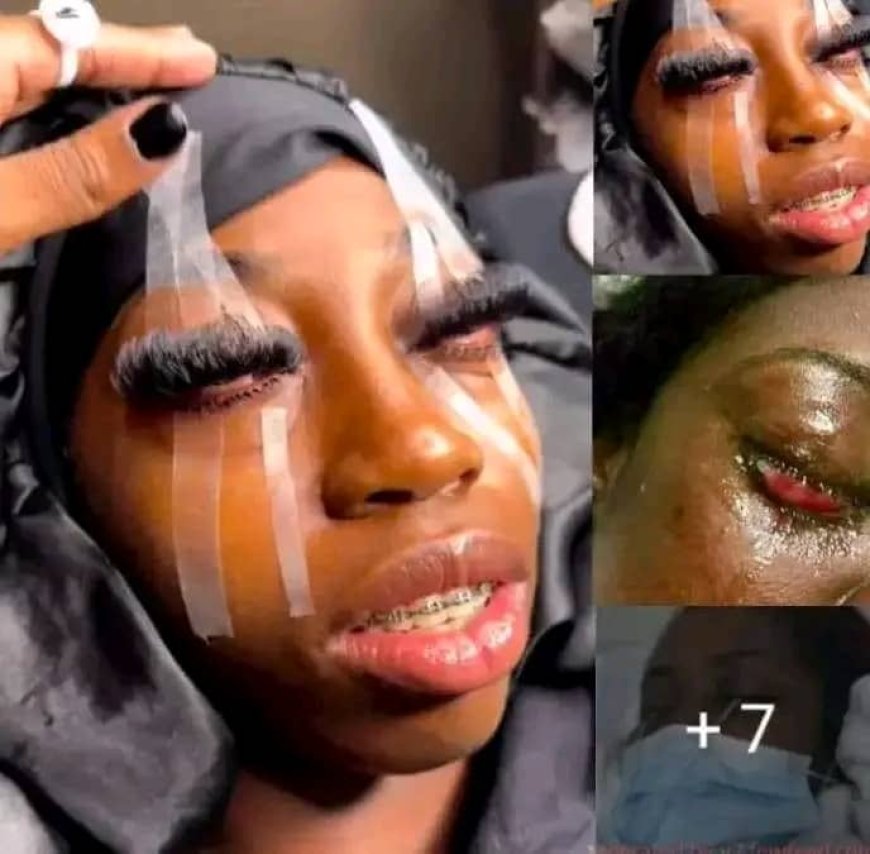 Tshopo: une jeune dame devient aveugle suite au mauvais traitement de beauté de ses cils
