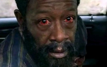 Conjonctivite à Kinshasa (Apollo) : « La maladie est très contagieuse et peut-être évitée grâce à l’hygiène des mains et éviter de frotter les yeux avec les doigts » (Dr Muyembe)